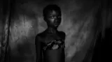 První cena v kategorii Problémy dnešní doby (série). Zakázaná krása. Praxe zažehlování prsou dívkám ve věku mezi 8 a 12 lety je v Kamerunu běžná. Lidé věří, že tím oddálí dospívání dívek a uchrání je tak před nebezpečím znásilnění a sexuálního zneužívání.