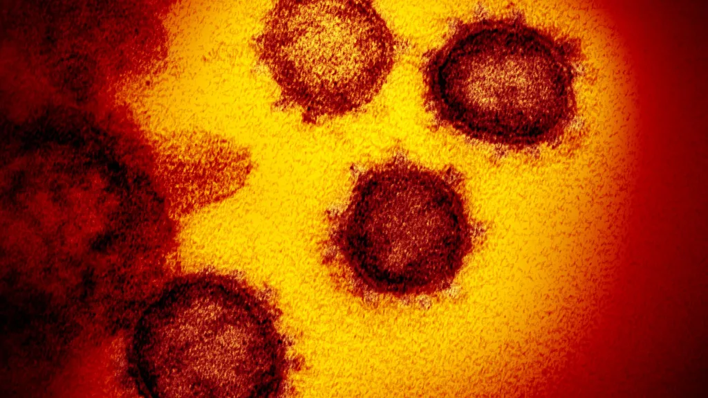 Počítačem vytvořená vizualizace koronaviru