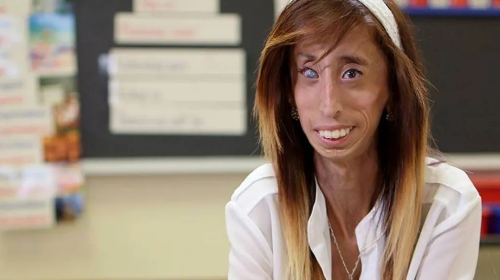Lizzie Velasquezová
