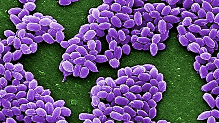 Snímek anthraxu pod mikroskopem