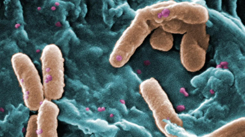 Bakterie pseudomonas