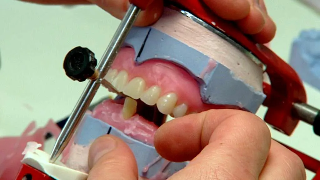 Zubní náhrada