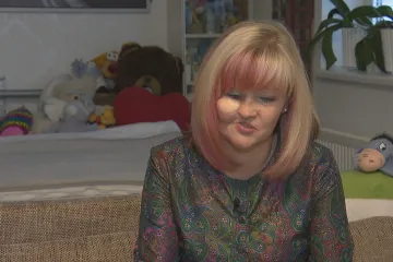 Češka po vážné nemoci podstoupila rekonstrukci obličeje. Zaplatit ji pomohli dárci