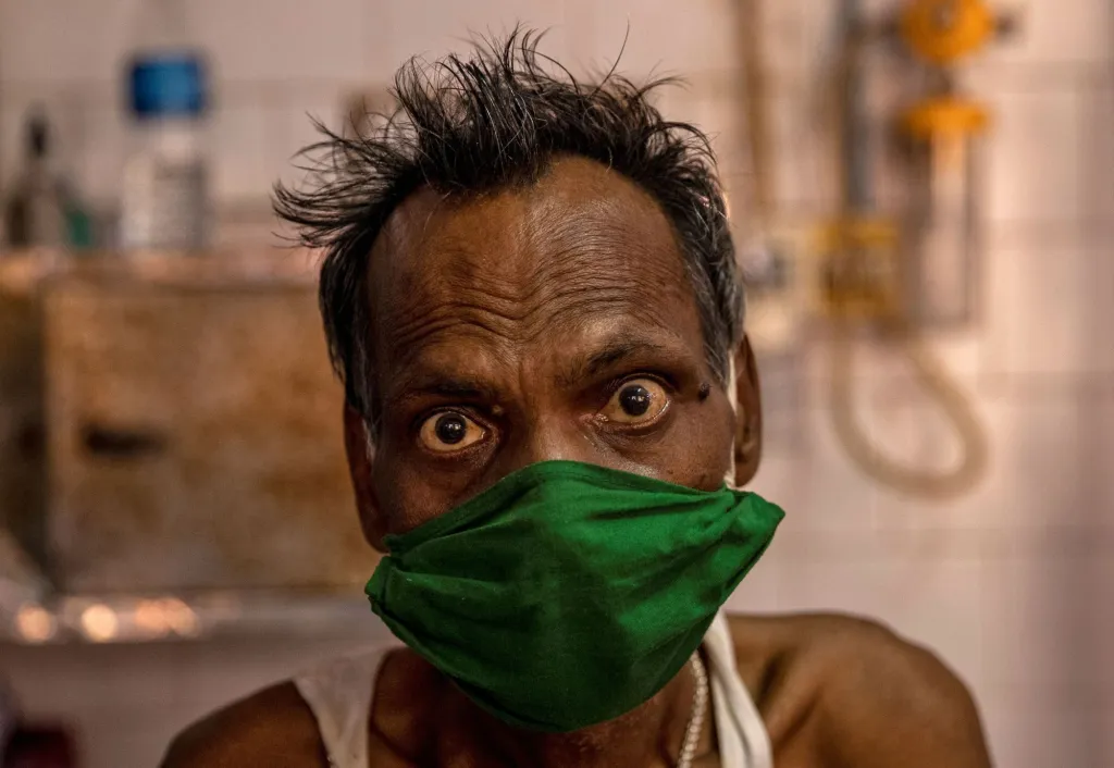 Pacient v roušce poté, co byl přijat na pohotovost do nemocnice v indickém Bhagalpuru. Bihár, Indie, 2020