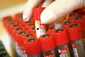 Vakcína Johnson & Johnson proti HIV selhala. Její neúspěch ukazuje, že systém kontroly funguje