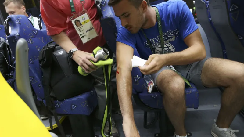 Novinář zraněný po útoku na autobus v Riu