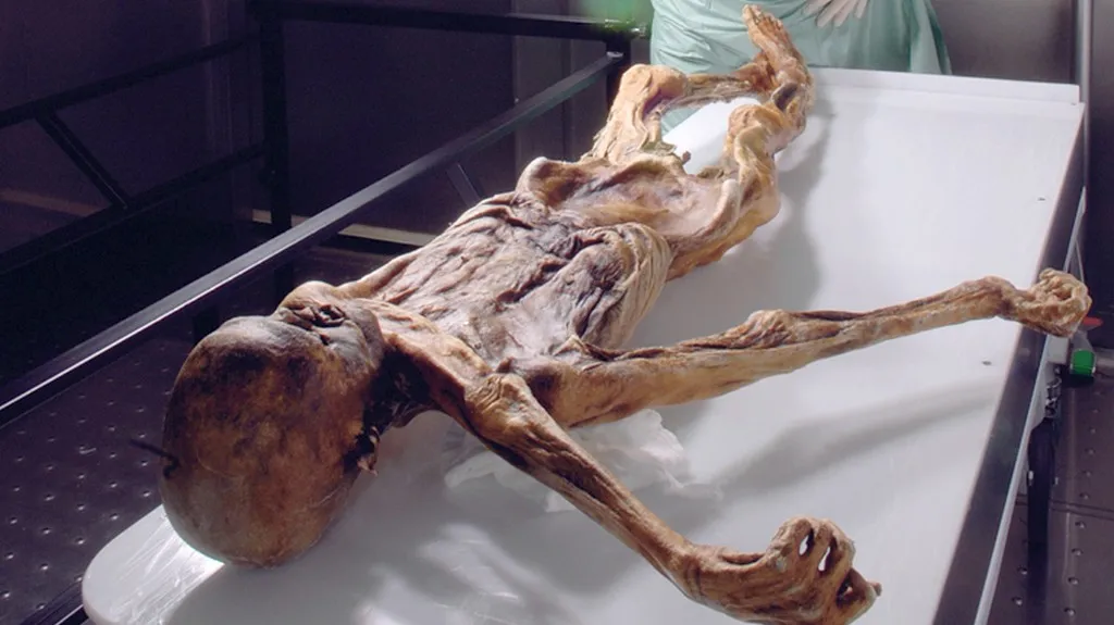 Ötzi
