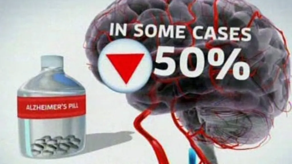 Léčba Alzheimerovy choroby