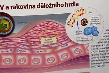 Prevence proti rakovině děložního čípku je dostupnější