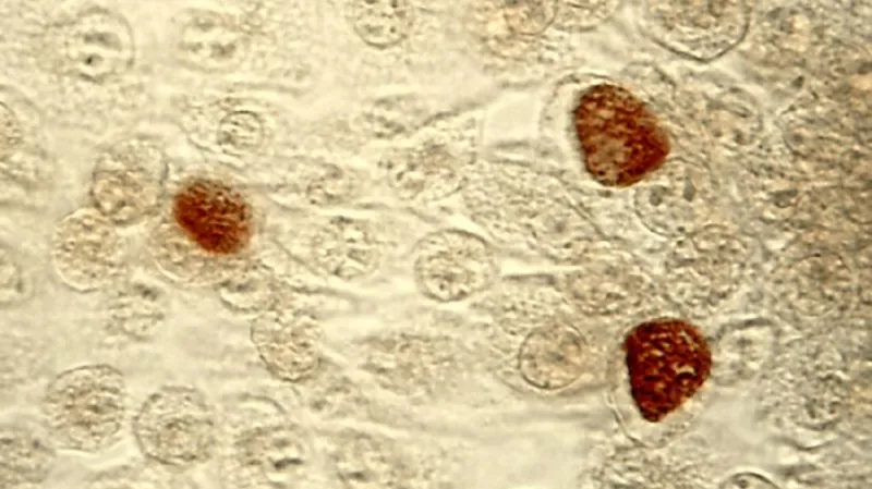 Chlamydia trachomatis