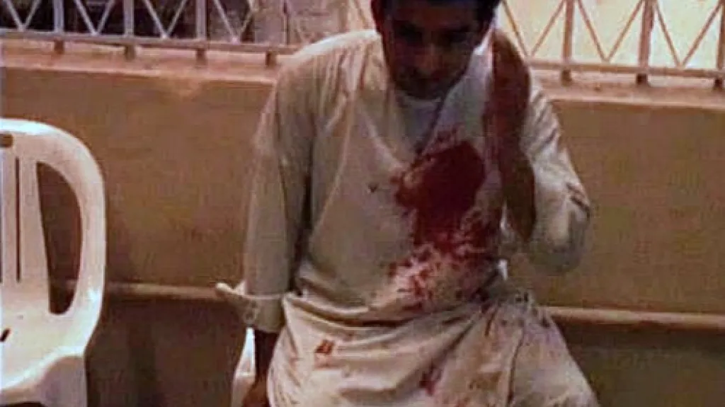 Muž zraněný při teroristickém útoku