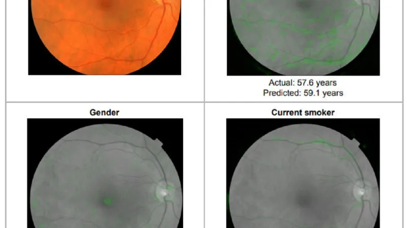 Co poznala umělá inteligence z lidského oka