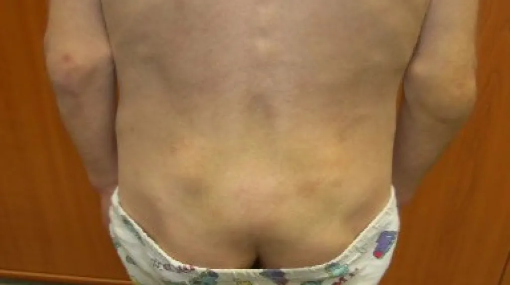 Týraný chlapec byl extrémně vyhublý a měl tělo plné modřin