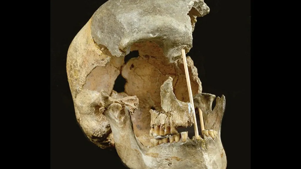 Lebka ženy přezdívané Zlatý kůň