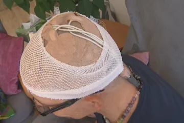 Inovativní léčbu rakoviny mozku začala proplácet pojišťovna