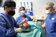 Za smrt muže s transplantovaným prasečím srdcem může virus, ukázal výzkum