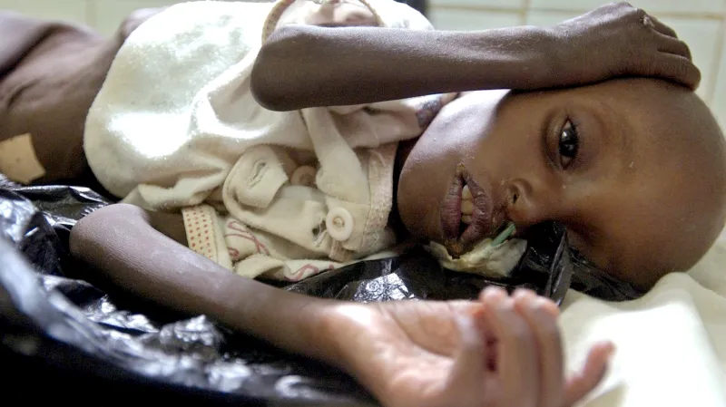 Podvyživené dítě