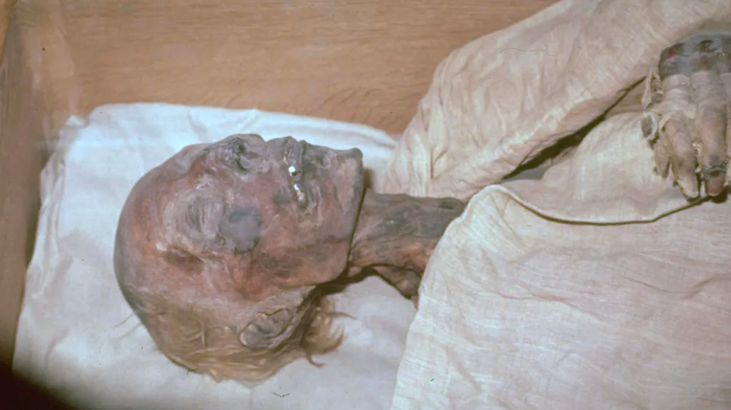 Mumie Ramesse II.