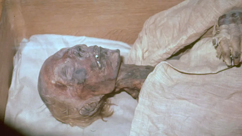 Mumie Ramesse II.