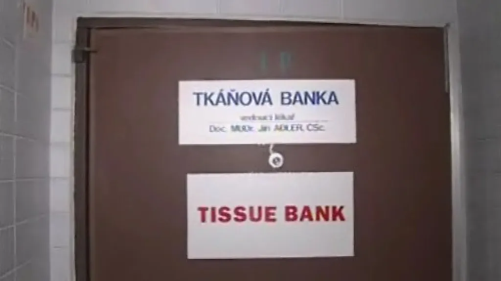 Tkáňová banka