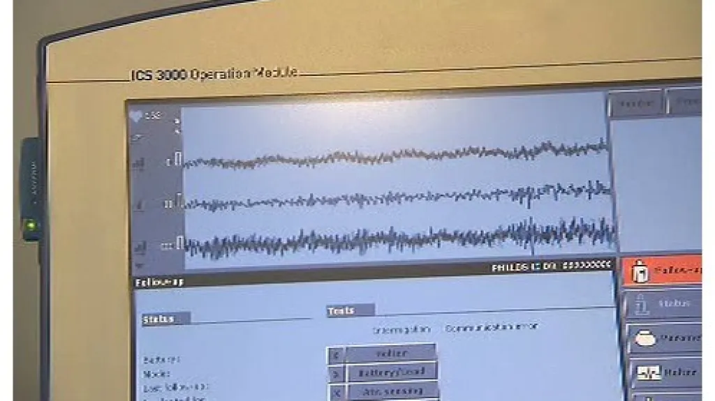 Monitor zobrazující srdeční činnost