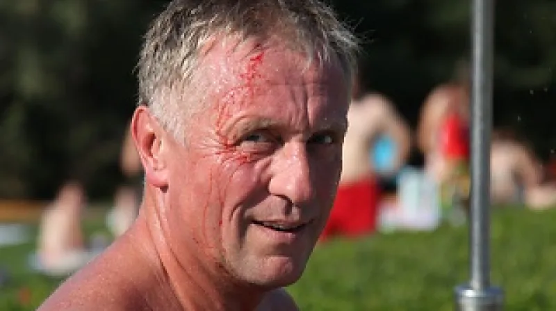 Zraněný Mirek Topolánek