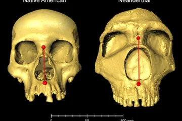 Za některé migrény a závratě možná mohou geny neandertálců