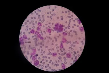 Čeští vědci objevili mutaci, která se podílí na vzniku leukémie