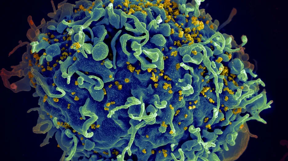 Virus HIV (žlutě) napadá lidskou buňku