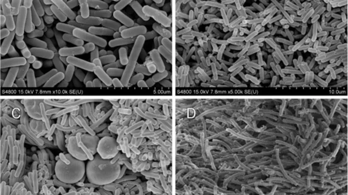 Lactobacillus kefiranofaciens pod mikroskopem