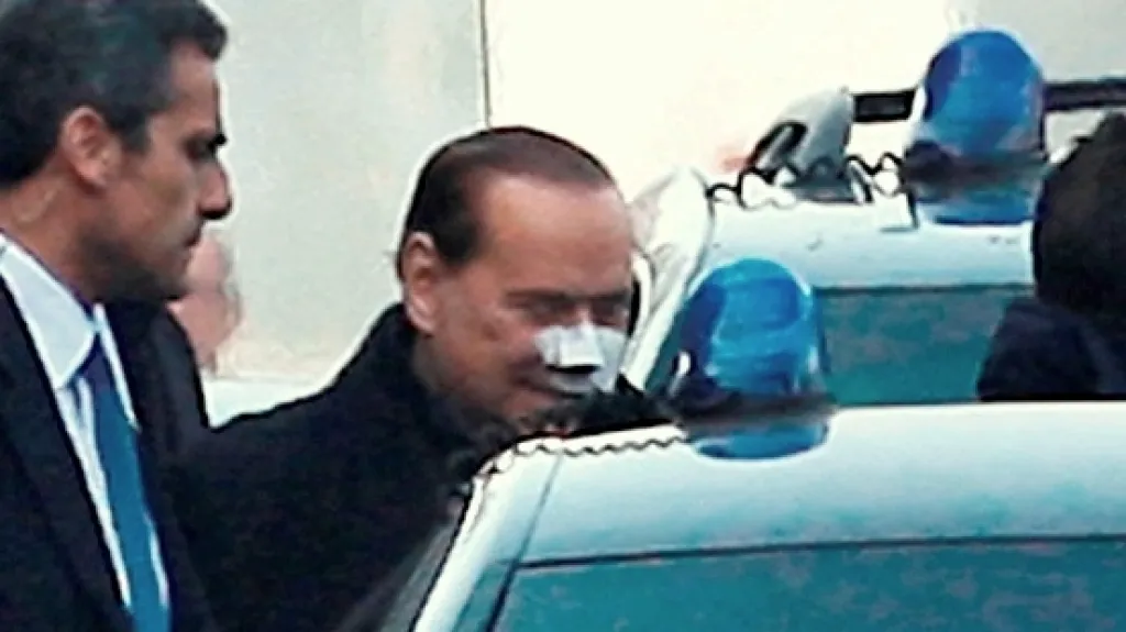 Silvio Berlusconi opouští milánskou nemocnici