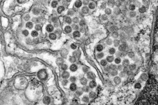 Virus MERS se na Slovensku zatím neprokázal – nutné jsou však další testy