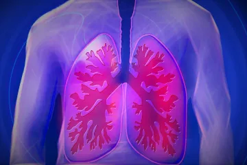 Česká pacientka využívala před transplantací 143 dní umělou plíci, podle lékařů jde o světový rekord