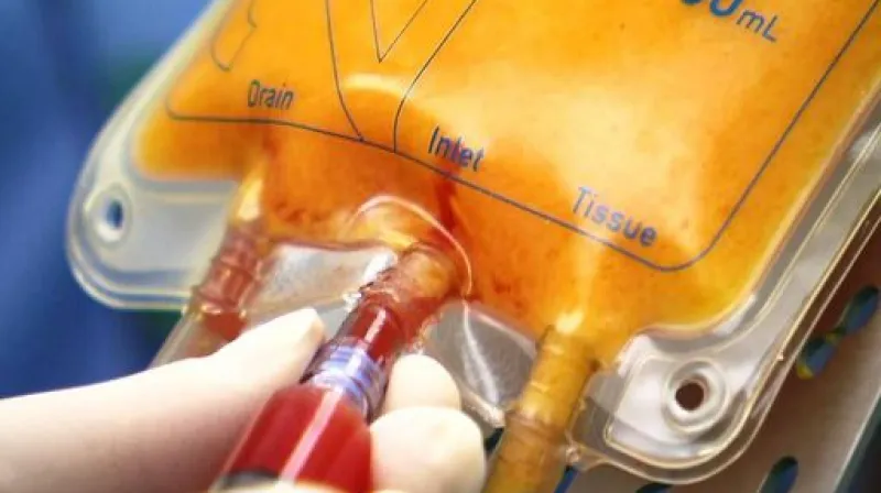 Plastický chirurg Libor Kment ve Studiu ČT24