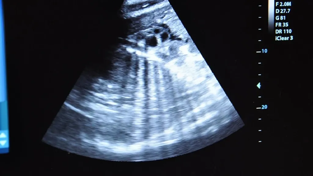 Ultrazvuk samice Tamary