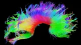Skeny lidského mozku