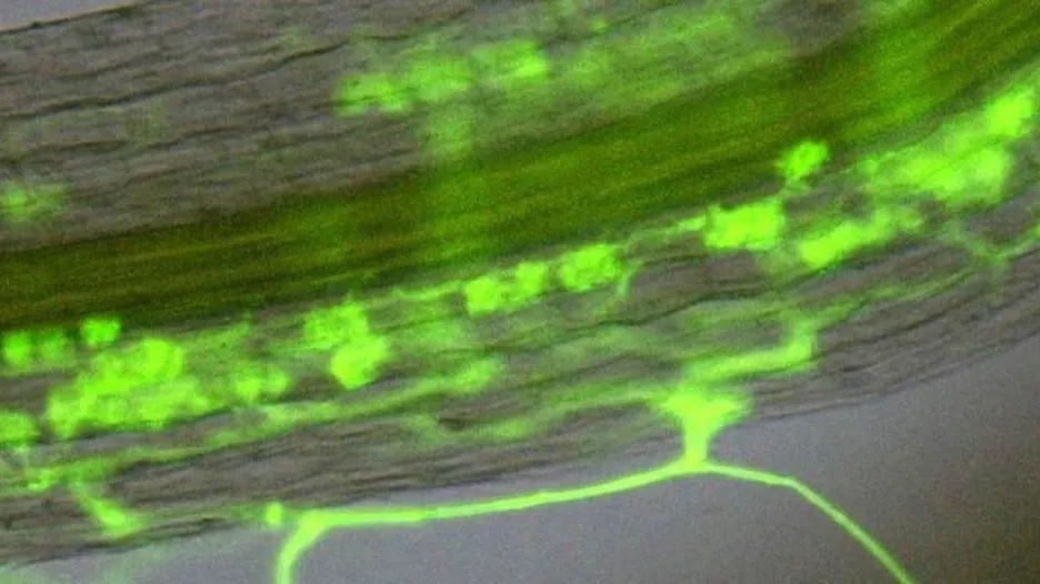 Mykorhiza pod mikroskopem