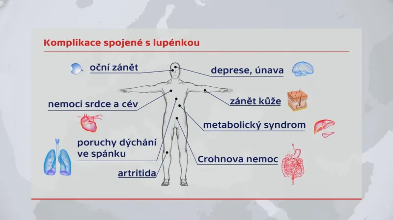 Komplikace spojené s lupénkou