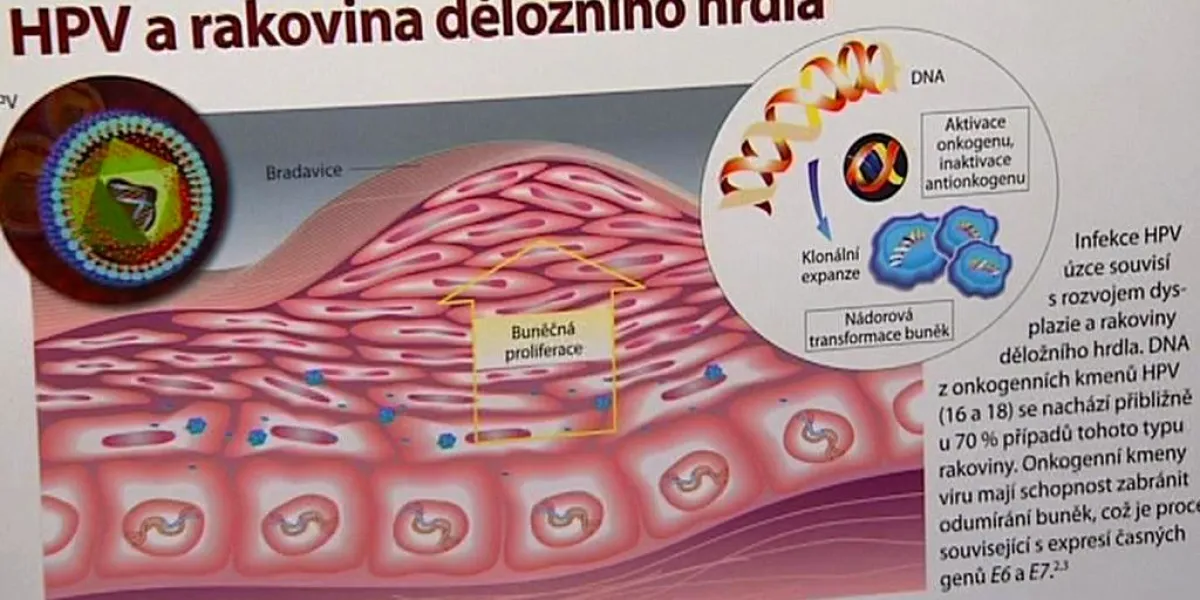 Nové Testy Snáz Odhalí Hrozící Rakovinu Děložního čípku Ženy Se Testují Málo — Čt24 — Česká 0771