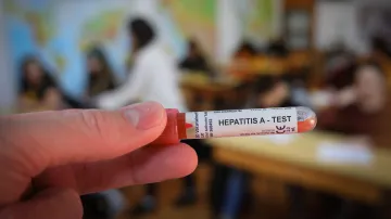 Test na žloutenku typu A