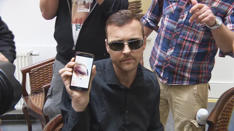 Číšník, který utrpěl vážná poranění při útoku skupiny Nizozemců v centru Prahy