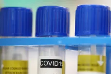 Olomoucká laboratoř začala s testováním vzorků s podezřením na koronavirus. Zvládne jich až tisíc denně 