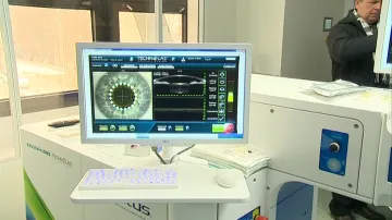 Operace šedého zákalu pomocí laseru je bezpečnější a šetrnější