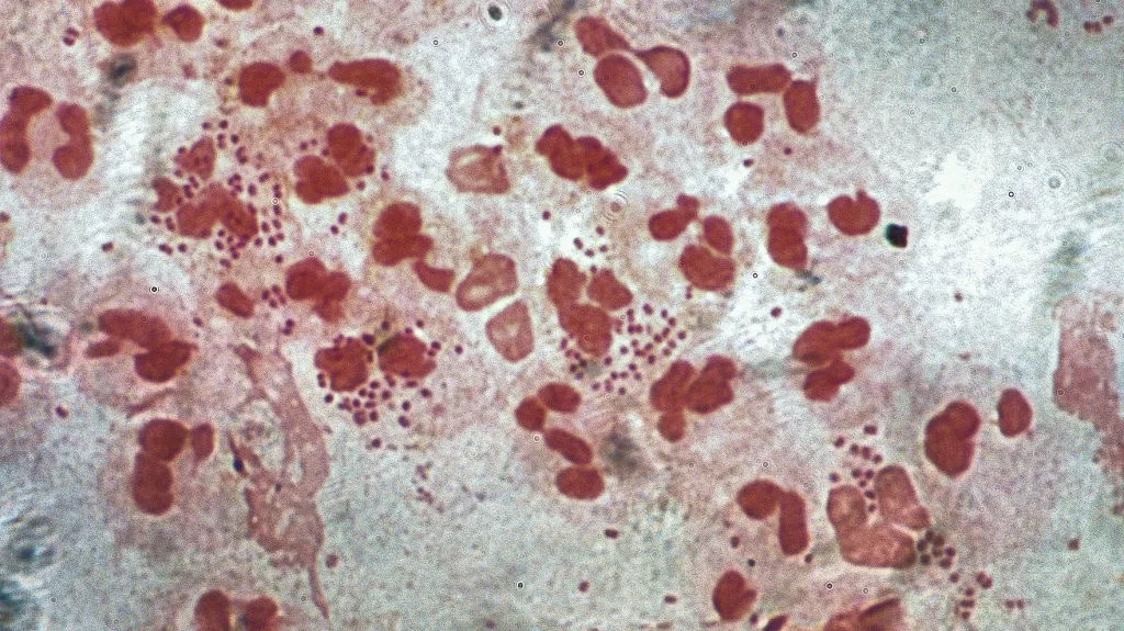 Bakterie Neisseria gonorrhoeae