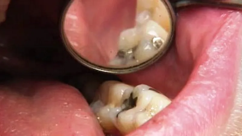 Prohlídka u zubaře