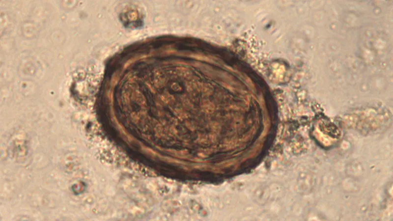 Vejce škrkavky nalezené v římské pevnosti