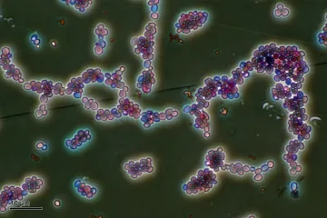 Antibiotika mohou zvýšit riziko smrtících plísňových infekcí. Narušují rovnováhu ve střevech
