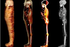 Vědci digitálně rozbalili mumii Zlatého chlapce. Našli desítky amuletů