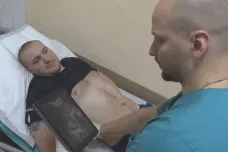 „Nevíme, co bude za pět vteřin.“ Štáb ČT natáčel na Ukrajině s lékaři nedaleko fronty