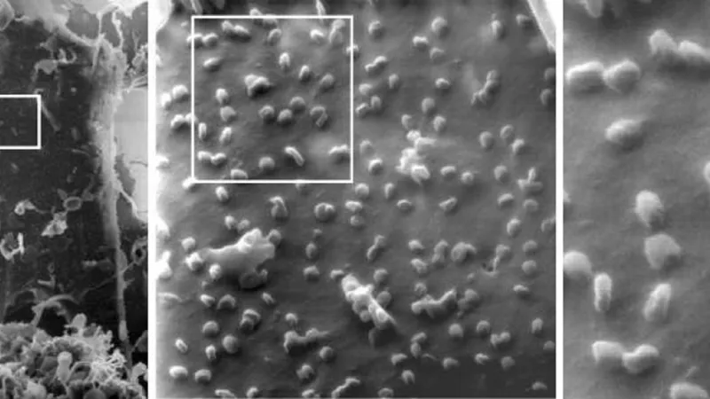 SARS-CoV-2 pod mikroskopem útočící na buňky ledvin